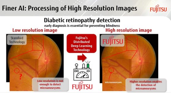 fujitsu_retinopatia-diabetica.jpg